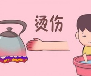 小孩烫伤起泡怎么办 涂抹牙膏能减轻疼痛吗